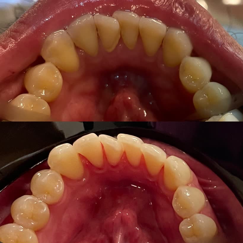 Antes e depois: Limpeza profissional